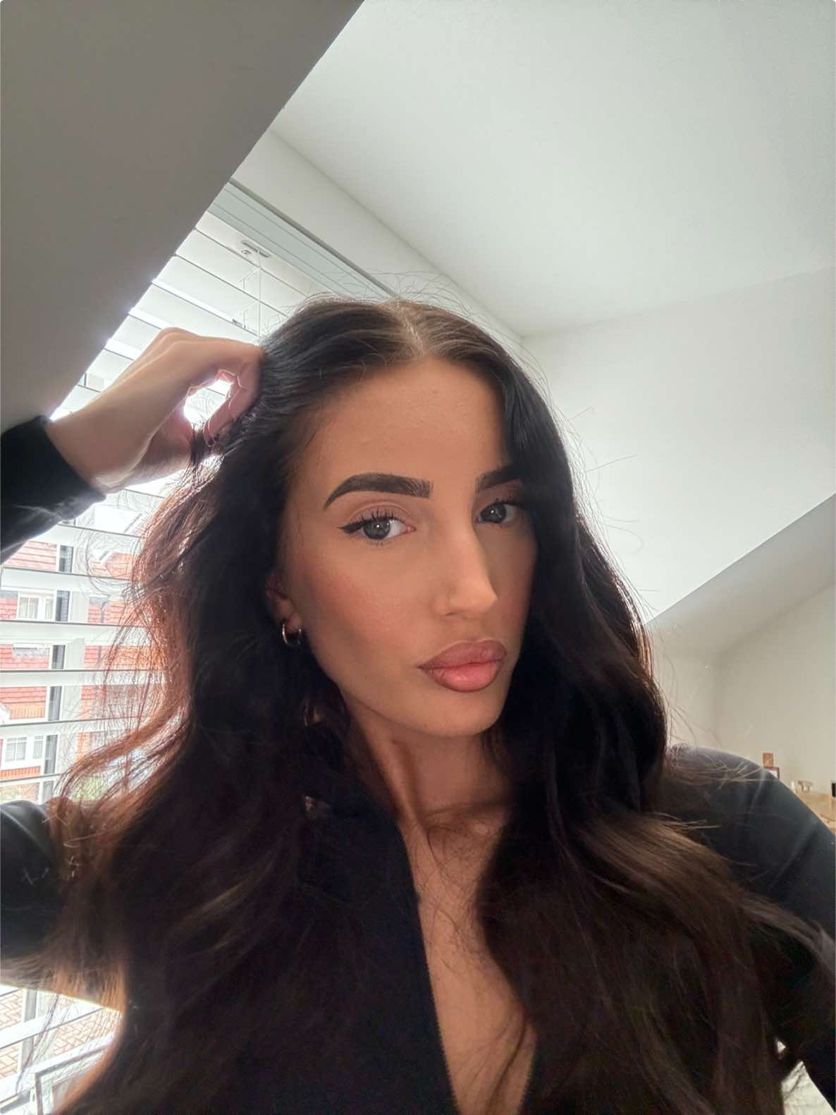 Set 3 out of 8 complete, onto set 4 😭 it’s pretty much painless now! Can’t wait to show you guys the process ♥️ Invisalign journey with Smile Architect, Harley Street 🥹