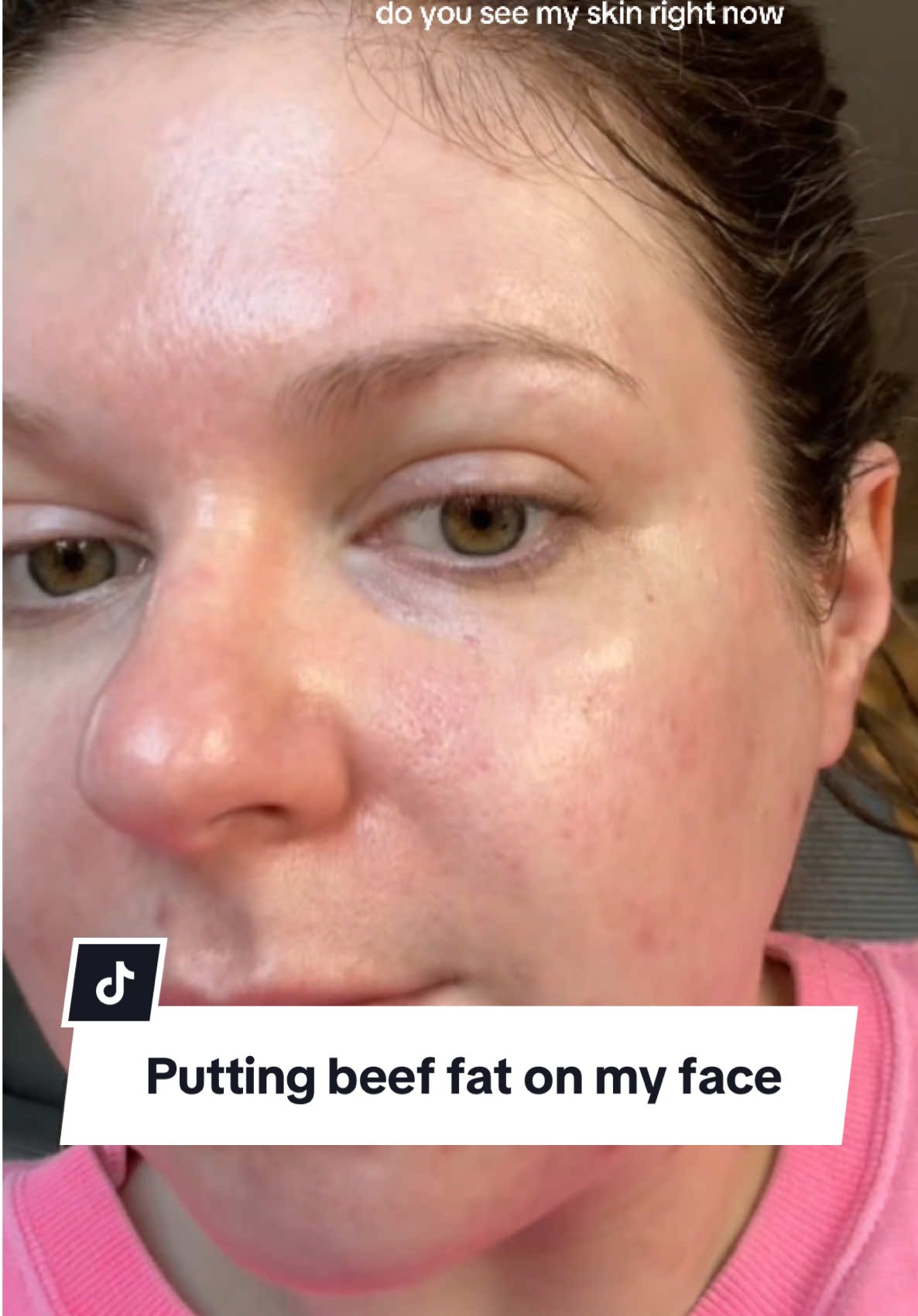 This feels crazy 😅 🐄 #beeffat #beeftallow #beeftallowskincare #beeftallowfacecream #SkincareSecrets #moisturizer #acneskin #acneproneskincareroutine #skinhealth #Inverted 