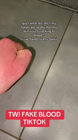 i am sick of this 😭😭 #fyfyfyfy #foryoupage #4upage #foryou #4u #fyp #4you #fakeall #viralvideos #xybzca #fakeblood #foryoupage #4upage #foryou #4u #fyfyfyfy #fyp 