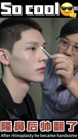 #rhinoplasty #nose #鼻修复 #鼻综合 #鼻整形 #鼻子 #帅哥 #handsome #handsomeboy 