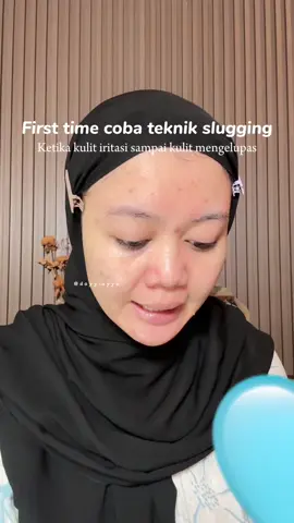 ✨ Pakainya di malam hari ya ! ✨ sebisa mungkin kalau kondisi kulit lagi seperti itu hindari dulu menggunakan micellar water ✨ puasa active ingredients dulu ✨ kondisi muka harus bnr brn bersih yaaa !