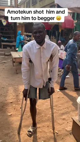 Amotekun shot him in 2021 and refused to cater for his health so he plead for help from Ondo state government and they promised him #30m but yet to be received by 𝕄r Rotimi @AYANFE ELEDUMARE 💫🤍✨@a.a_clown @Riike👸 @omoga_02 