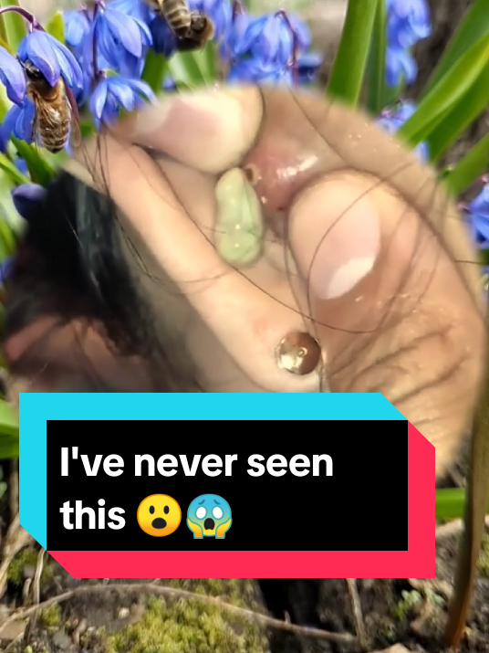 That was soooo good! 🤯😲🥰 #acnes #oddlysatisfying #satisfyingvideo #relaxing #pimple #blackhead 