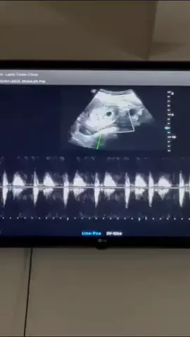 اللهم لكَ الحمد🥹❤️ثاني عطايا الرحمن وثاني ثمرة حُب 🙏🏻😭#حمل #حوامل #بيبي #بشاره #فرح #سونار #مولود #الشعب_الصيني_ماله_حل😂😂 #مالي_خلق_احط_هاشتاقات #مشاهير_تيك_توك #مشاهير_تيك_توك_مشاهير_العرب #عمان #عراق #حبيبي❤️ 