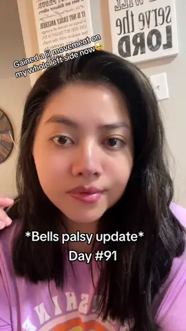 Bells palsy sucks ! Day 91 so much improvement. With neurobion injections ! #bellspalsyawareness #bellspalsyrecovery #facialparalysis #update 