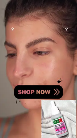 #sarahskin #beauty #GlowUp