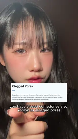 this is how I treated my clogged pores#koreanskincare #skincare #kbeauty #kbeautyskincare #anuacleansingfoam #skin1004cleansingoil #anuaniacinamideserum #dralthea #dralthea345cream #cloggedpores #skincaretip