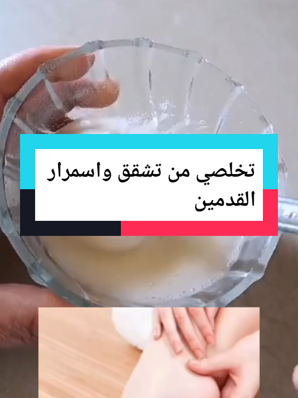 #تخلصي من تشقش القدمين#ازالة -الجلد-المية#تنعيم #القدمين #طرطيب #فوري #وصفة_سهلة #zoommyface #fürdich #اكسبلوررررر #الشعب_الصيني_ماله_حل😂😂 