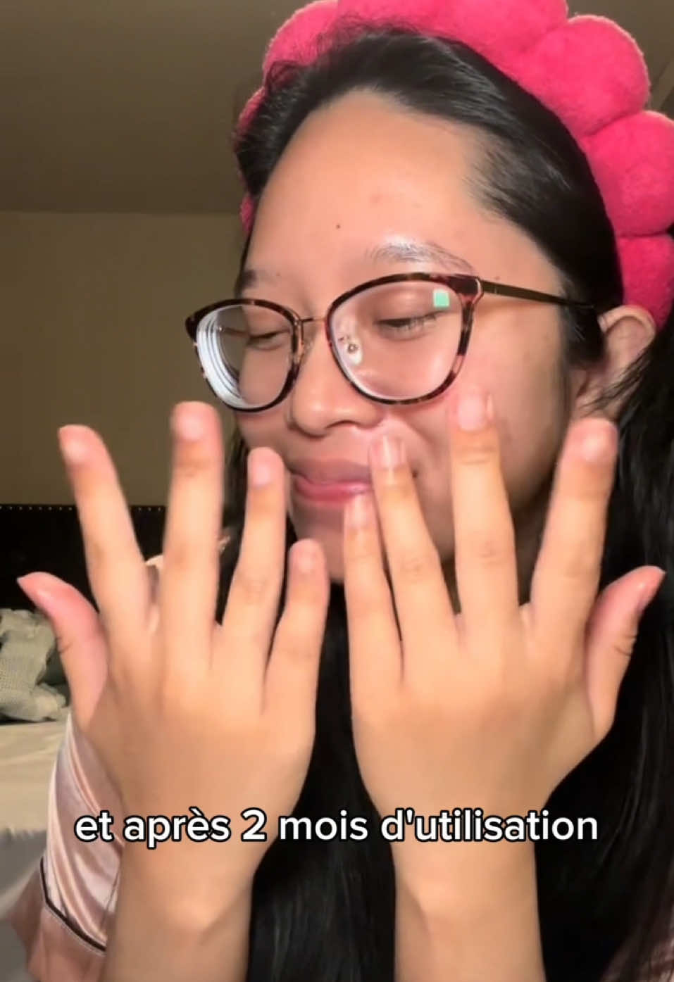 💅 Découvrez le secret pour des ongles parfaits ! Vous en avez assez des ongles qui se cassent ou ne poussent jamais ? Notre sérum enrichi en vitamines et huiles naturelles est la solution qu’il vous faut. En seulement quelques semaines, vos ongles seront plus forts, plus longs et en pleine santé. ✨ 🌟 Les bienfaits : • Accélère la croissance naturelle • Répare et renforce les ongles abîmés • Protège contre les cassures et la sécheresse 💚 Offrez à vos ongles le soin qu’ils méritent avec une solution naturelle et facile à intégrer dans votre routine. 📦 Bénéficiez de -40% aujourd’hui et démarrez votre transformation dès maintenant ! Disponible sur Glizabeauty.com #ongleslong #onglenaturel #onglesaddict #glizabeauty 