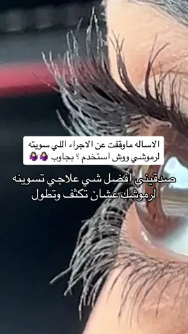 هذي المره المليون اللي اجاوب وما ازهق وانا اجاوبكم ..♥️ . . . . . . . . . #الرياض #fyp #عنايه #اهتمام #تكثيف_الرموش #رموش #رموش_طبيعيه #رموش_دائمة #كحل #اثمد #الاثمد #اكتحال #تكثيف #تطويل_الرموش_وتكثيفه #تطويل 