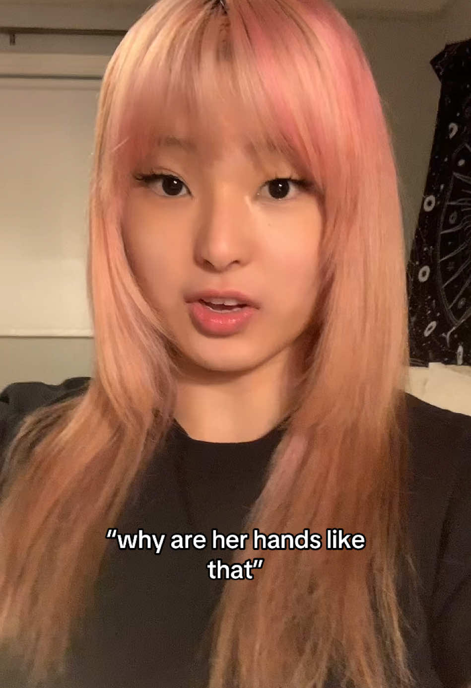 this wasn’t easy to film so please be nice in the comments #syndactyly #syndactylie #birthdeffect #deformity 