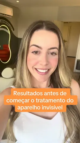 Só 7 meses de tratamento e já tem resultado de como vai ficar 🧡🧡🧡 #aparelhoinvisivel #resultados #odontologia #transformation 