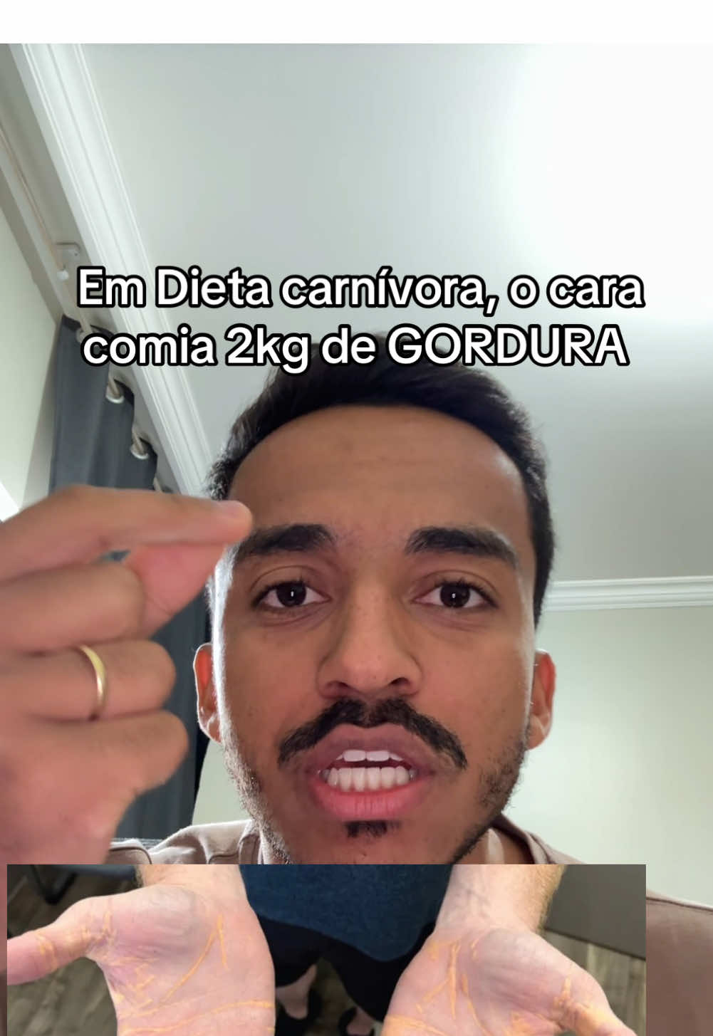 Inacreditável #dietacarnivora #colesterol 