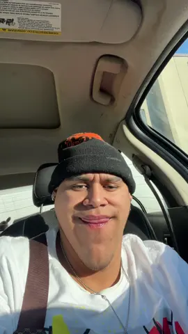 Barbilla roja después de la quemazón ##paratiiiiiiiiiiiiiiiiiiiiiiiiiiiiiii##fpy##xyzbca##zxamir