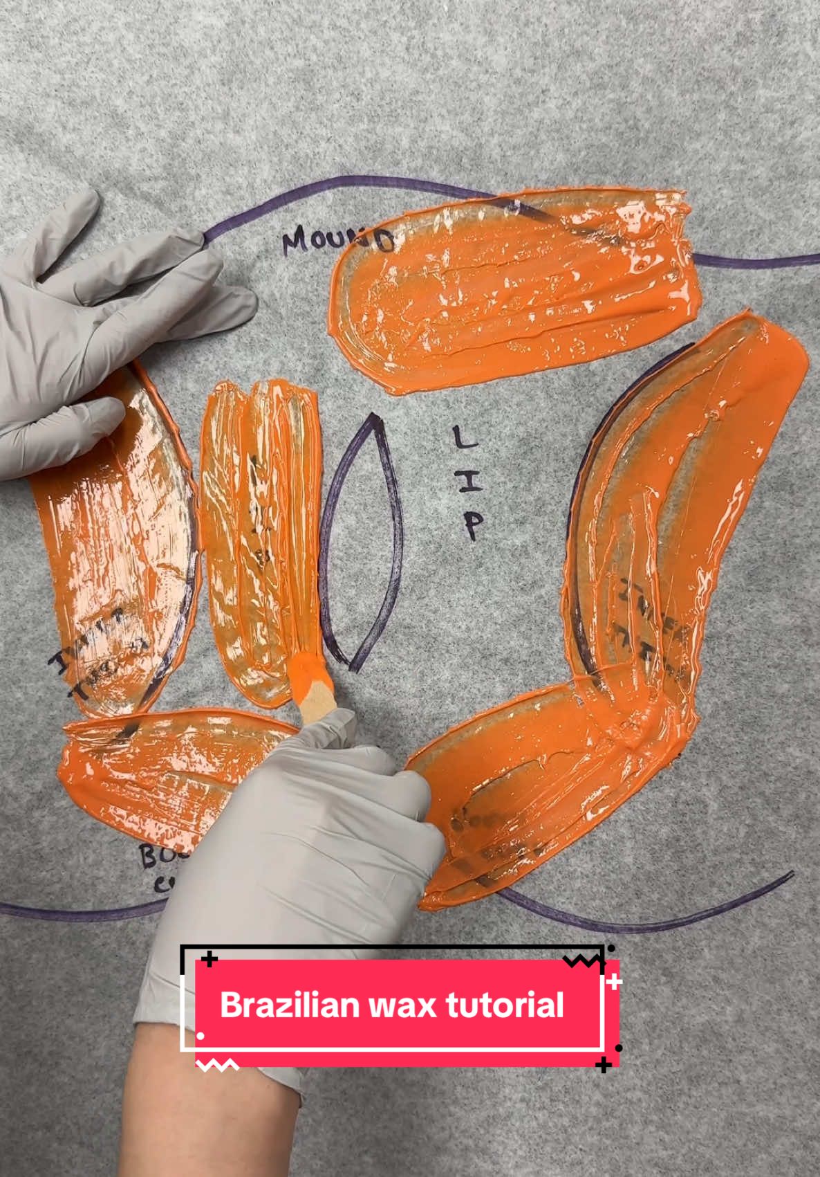 My 15 minute Brazilian wax tutorial! This pattern is perfect for beginners and new waxers! #esthetician #waxing #waxingvideos #wax #asmr #satisfying #oddlysatisfying 