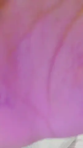 #fybシ #habeshatiktok #pageforyou🦋 #pageforyou_🔥 #pageforyou #pageforyou_🔥trending💔video #habeshagirl #duet 