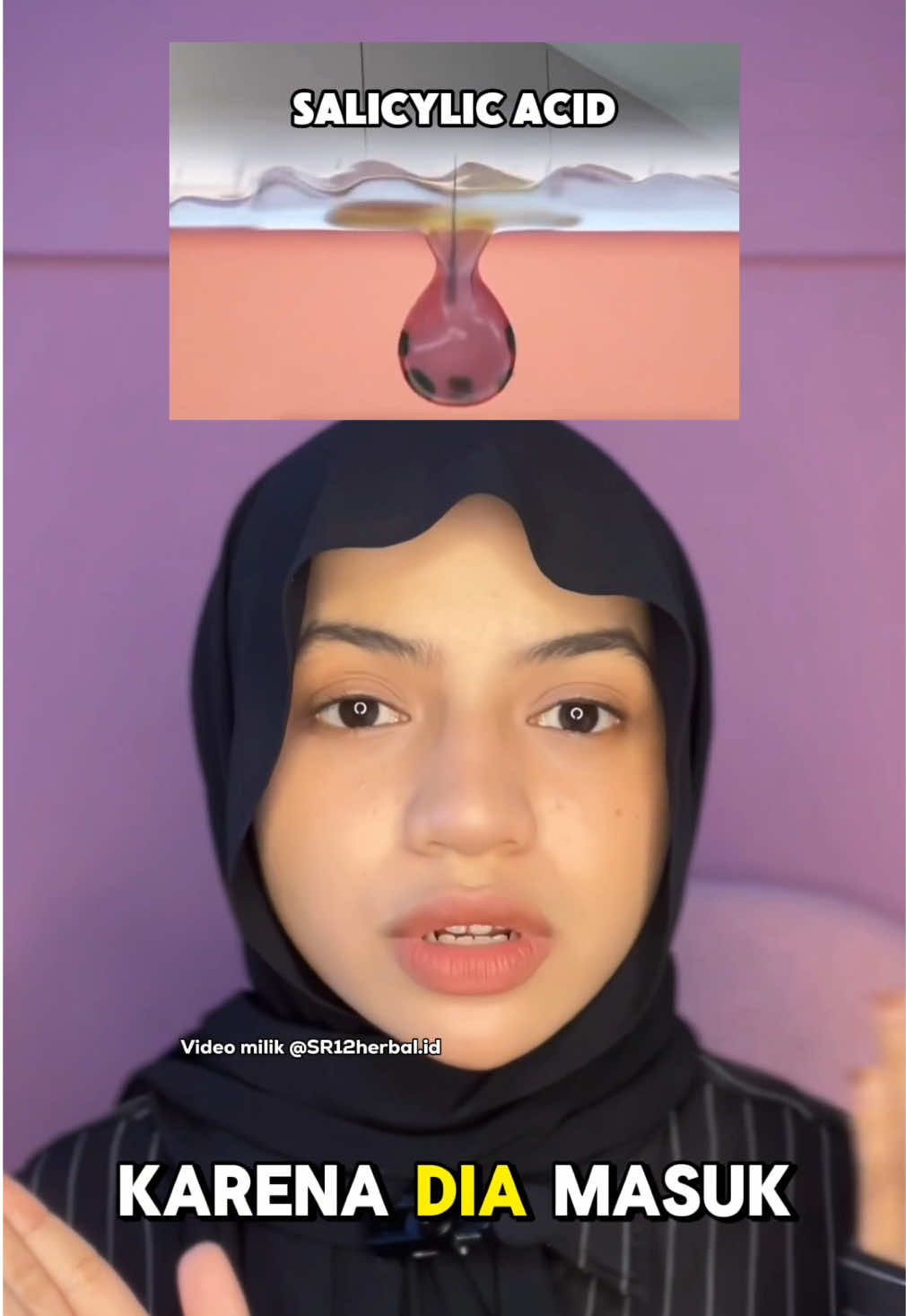 Salicylic Acid sehebat itu untuk masalah kulit berminyak, berjerawat, bertekstur dan berkomedo? Yaps tentuu cobain Toner BhA SR12 dengan kandungan 1.5% jadi aman untuk kulit kamu #sr12 #tonerbha #salicylicacid #tonerbhasr12 