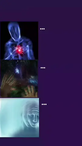 ...#rge #globalvideo #global #foryou #fypシ゚viral #viral #4upage #epilepsy #fyppppppppppppppppppppppp #goviral #4u #epilepsy #epilepsy 