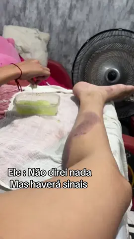 🤣🤣🤣 Eu não tive nem o direito de reclamar , estava errada 🤣 #exuu #espiritualidade #mediunida #terreiro #acidentedemoto 