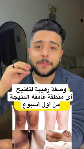 وصفة رهيبة لتفتيح أي منطقة غامقة.. النتيجة من أول أسبوع وبمكونات بسيطه موجوده في كل بيت  #تفتيح_الجسم #تفتيح_المناطق_الداكنة #تفتيح_الركب_الاكواع #تبيض_الجسم #خلطات_تبييض #خلطات_طبيعية 