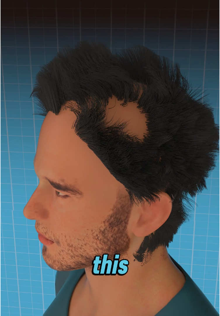 Is your hair falling more than usual ? this could be the reason!! #hairloss #hair #hairfalling #hairtok #mindmyst 