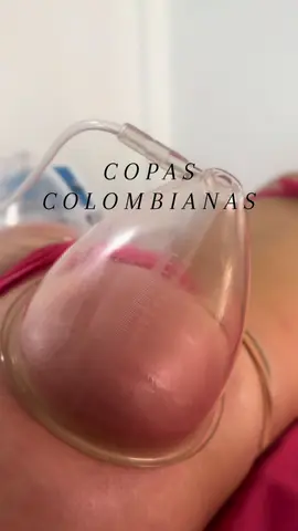 COPAS   COLOMBIANAS ✨  Tratamiento cero invasivo para aumento y levantamiento de Glúteo ⭐️  #spa #sanjeronimoaculco #paratiiiiiiiiiiiiiiiiiiiiiiiiiiiiiii #cdmx #fyp 