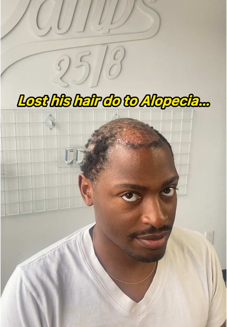 He lost his hair do to Alopecia and believed sharing his transformation would help somebody in a similar situation 🙏🏾 Schedule a consultation with Today at Hair By Choice 🦾 #alopecia #hairunit #hairsystem #montreal #toronto #paris #menshealth #MentalHealth #fyp #barber #mensfashiontips #menshair 