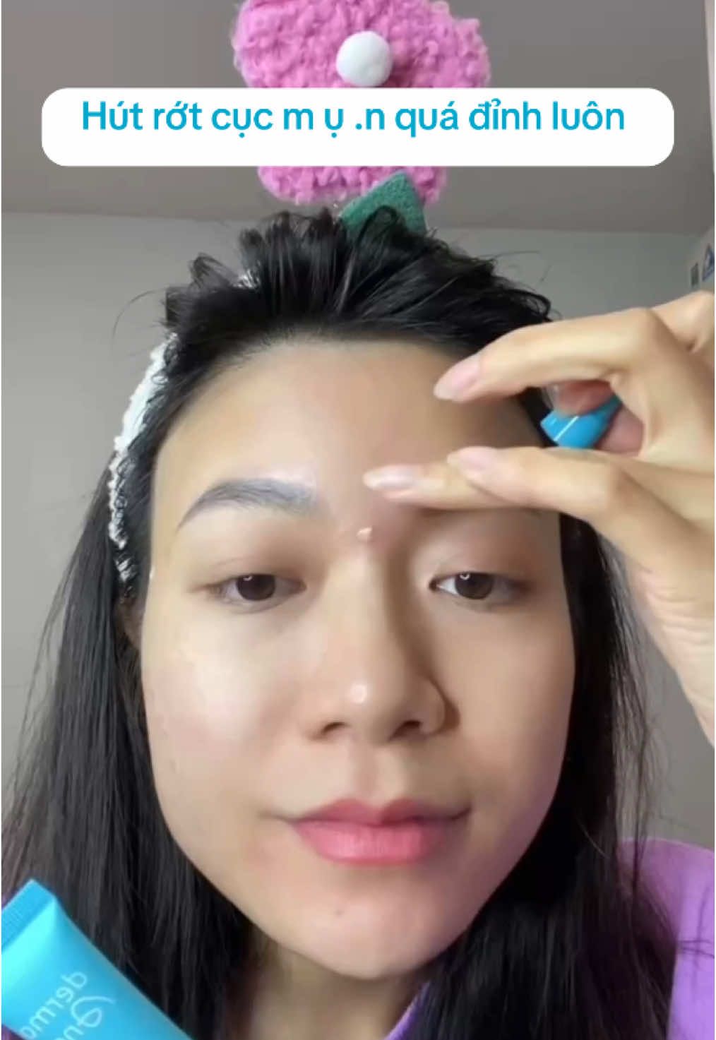 Miếng dán mụn chân ái, ra được đầu trắng luôn #dermaangel #dermaangelvn 