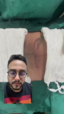 Mais uma sutura com fechamento intradérmico e fios absorvíveis, gostaram?#nascimento #cicatriz #sutura #gestacao #cesariana #gestacao #maternidade#greenscreen 