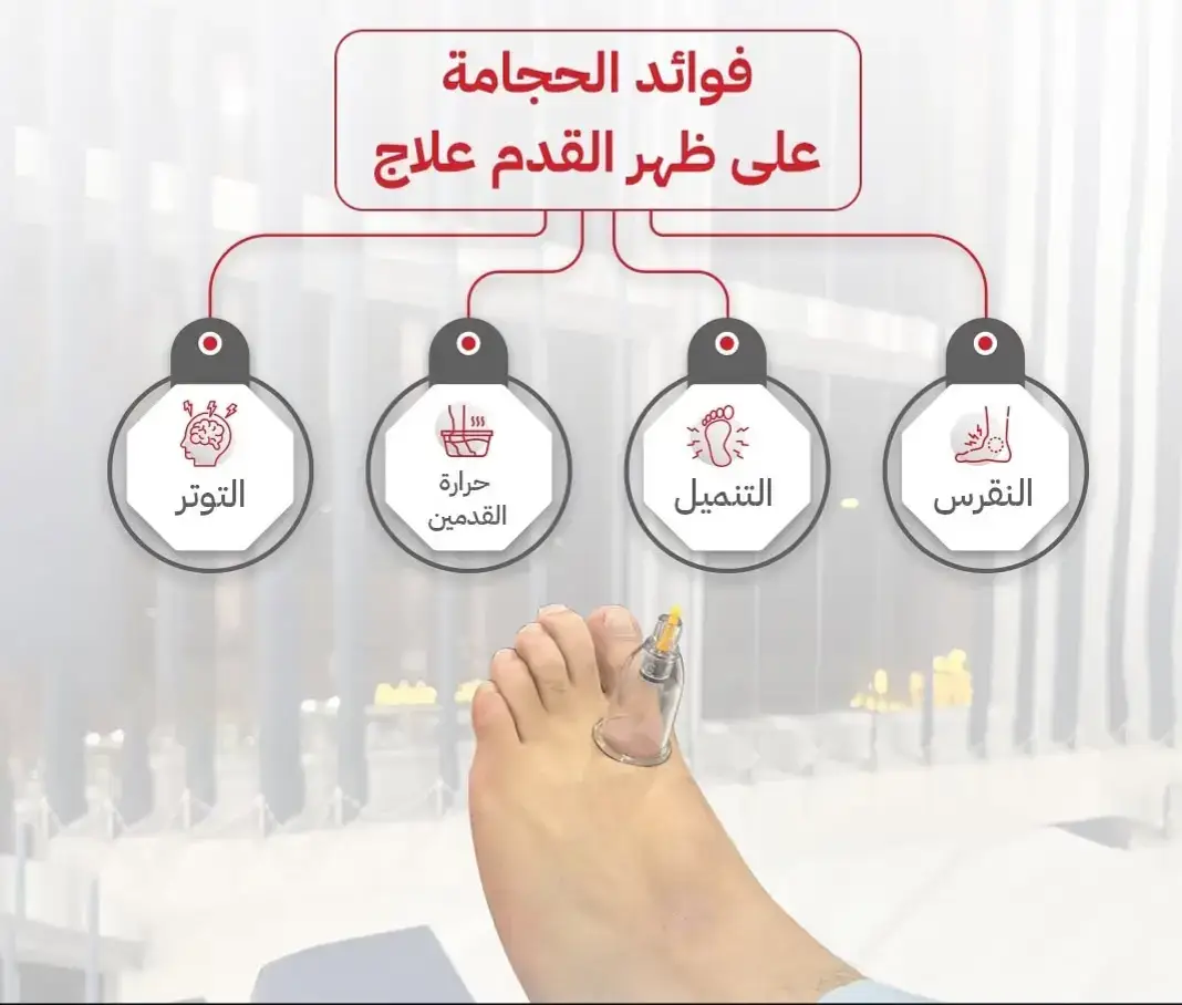 سلام عليكم ورحمة الله وبركاته 🤝 حاب تعمل حجامة سنية أو علاجية مرحبا بك عندنا 🧑‍⚕️🩸⚕️  ما تقدرش جي عندنا حنا نجيو عندك 😊 ( إمكانية التنقل إلى المنزل)🏠  📌لا تتردد في الاتصال للحجز أو الاستفسار على الرقم التالي: 0696457896 📞 👈👈لما تحجز معانا👇👇 😇تحصل على مميزات عديدة منها😊 💪تشريط لا يترك اثر💪 💪كؤوس و اداوات جديدة معقمة خاصه لكل حالة  💪 💪تعقيم قبل الحجامة و تطهير على أعلى مستوى💪 يسعدنا تلقي تعليقاتكم واستفساراتكم و الرد عليها. #hidjma #الحجامة #cupping_Therapy #ventouses #الحجامة_النبوية #santé #الطب_البديل  #Prélèvement_à_domicile #tlemcen #الفوطة_النارية #الموكسا #massage_aux_ventouses #sunnah_of_prophète الحجامة_النارية# الحجامة_الجافة# الحجامة_الدموية# #تلمسان #Fitness #sport #sportifs #health #adulte #enfant #moxa #hijama #الطب_التكميلي  #hidjma #cupping_Therapy #ventouses