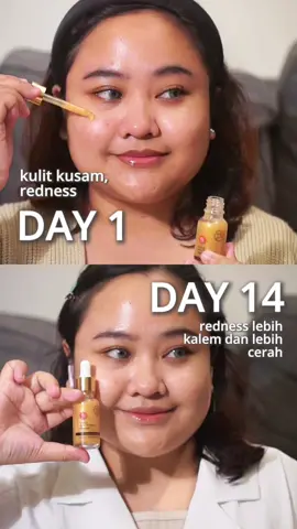 Serum sultan bikin kulit keliatan mahaaaalllll ✨ #serumviva #skincareviva #serumbrightening 