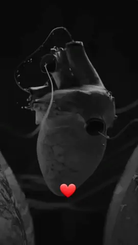 #انه #وانته #فرد #شريان 