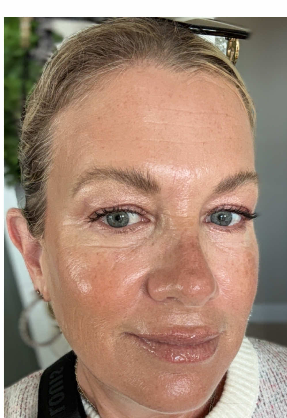 What a beautiful journey it has been! As a 55-year-old, I started this adventure with just a glimmer of hope six months ago, thinking my skin care days were behind me. Initially, it was just one week, then two weeks, and before I knew it, a month had passed with more progress than I ever dreamed possible. Discovering HYDROXYTYROSOL by Oliveda has been a revelation for my skin. The elasticity, the luminosity, everything feels alive again! Sometimes, the best gifts come later in life; all it takes is a little faith and patience. Cheers to every fellow aging beauty finding their glow! 🌼 #BeautifulAt55 #Hydroxytyrosol #OlivedaLove #SkinTransformation #confidenceinaging #olivedaglow #oliveda #BeforeAndAfter #oliveoil 