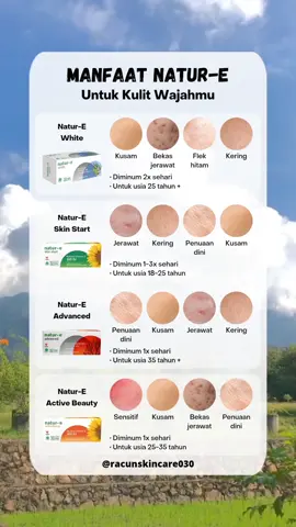 Manfaat Natur-E untuk kesehatan kulitmu dari salam, kalain tim yang varian apa nih?? #naturE #Suplemen #fyp #naturewhite #natureadvance #natureadvanced #nature100iu #nature300iu #naturewhiteningkapsul #kapsulnature #suplemennature #racunskincare030 