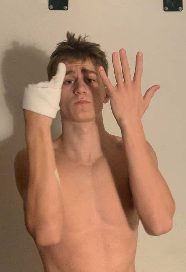 I lost 4 finger in an accident 1 month ago but I will get back to calisthenics ASAP