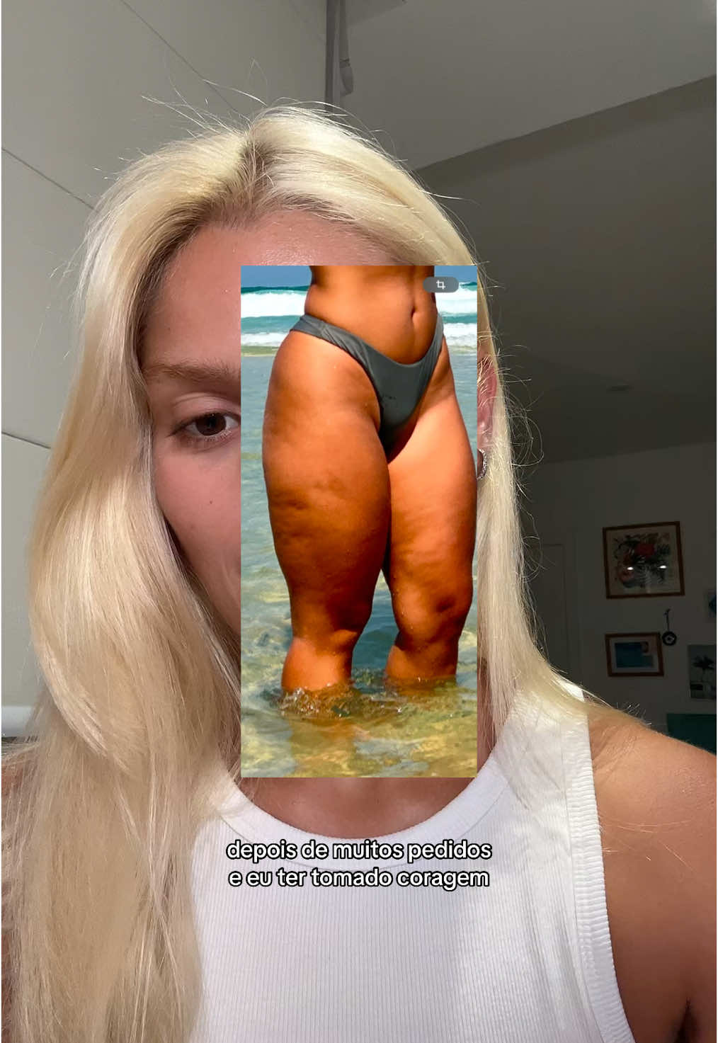 1° video introduzindo sobre o meu diagnóstico de Lipedema 🥹❤️  #lipedema #lipedemaawarenes 