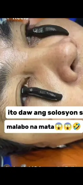 terapi mata pake lintah😨😱 #fypviraltiktok🖤シ゚☆♡ 
