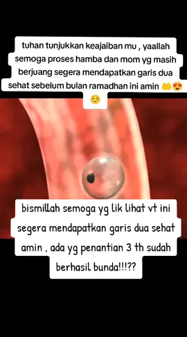 yaallah permudahkanlah segala urusan wanita hebat yg sedang berjuang amin 🤲🥹#pejuanggarisduamerah #bayilucu #masyaallahtabarakallah #semangatpejuanggarisdua #masaallah #bayitiktok #fyppppppppppppppppppppppp #kunfayakun 