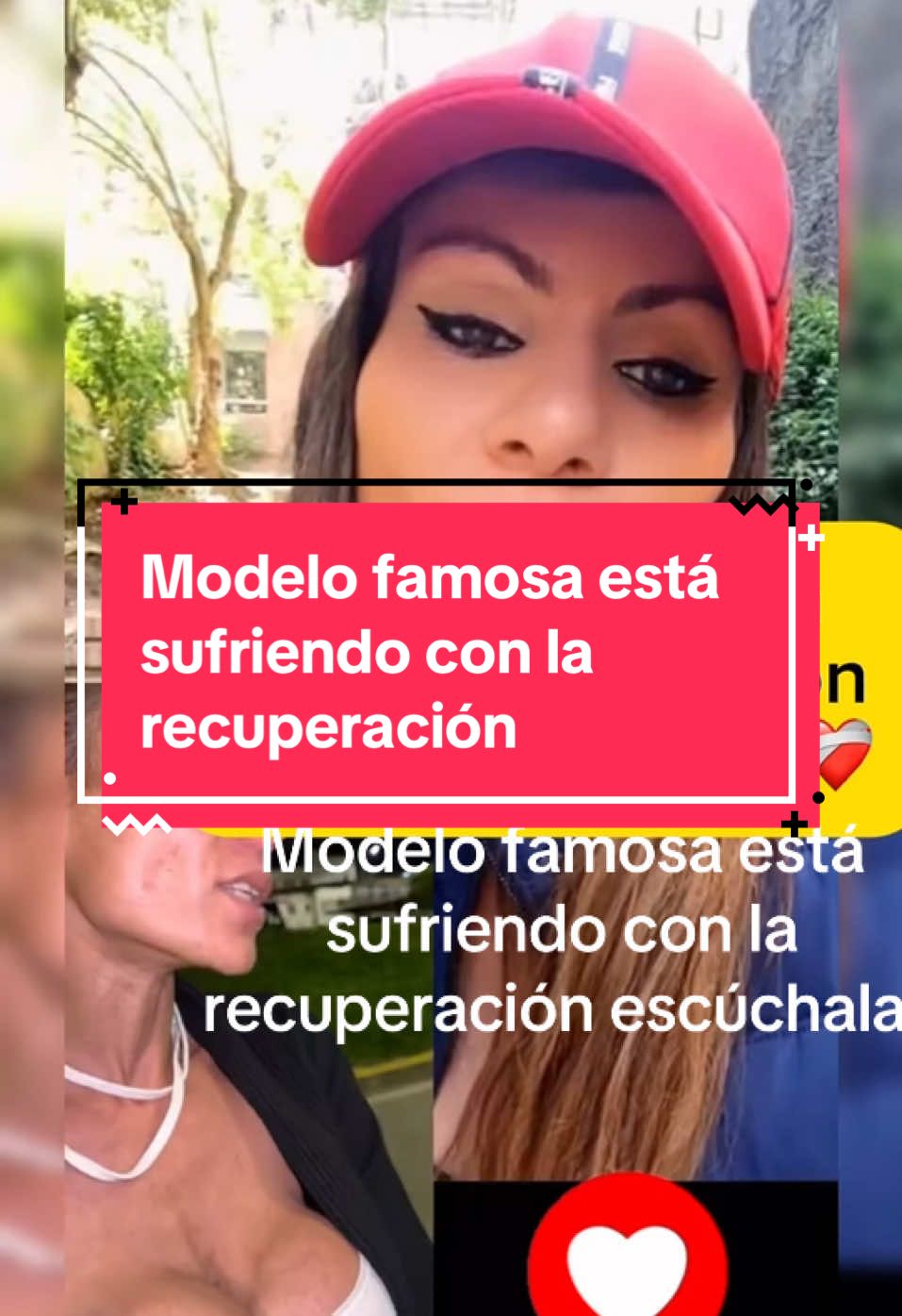 Modelo famosa está sufriendo con la recuperación #ingridkarina #topmodel #topmodels #paparazzi #family #casosdelavidareal😂 #modelo #model 