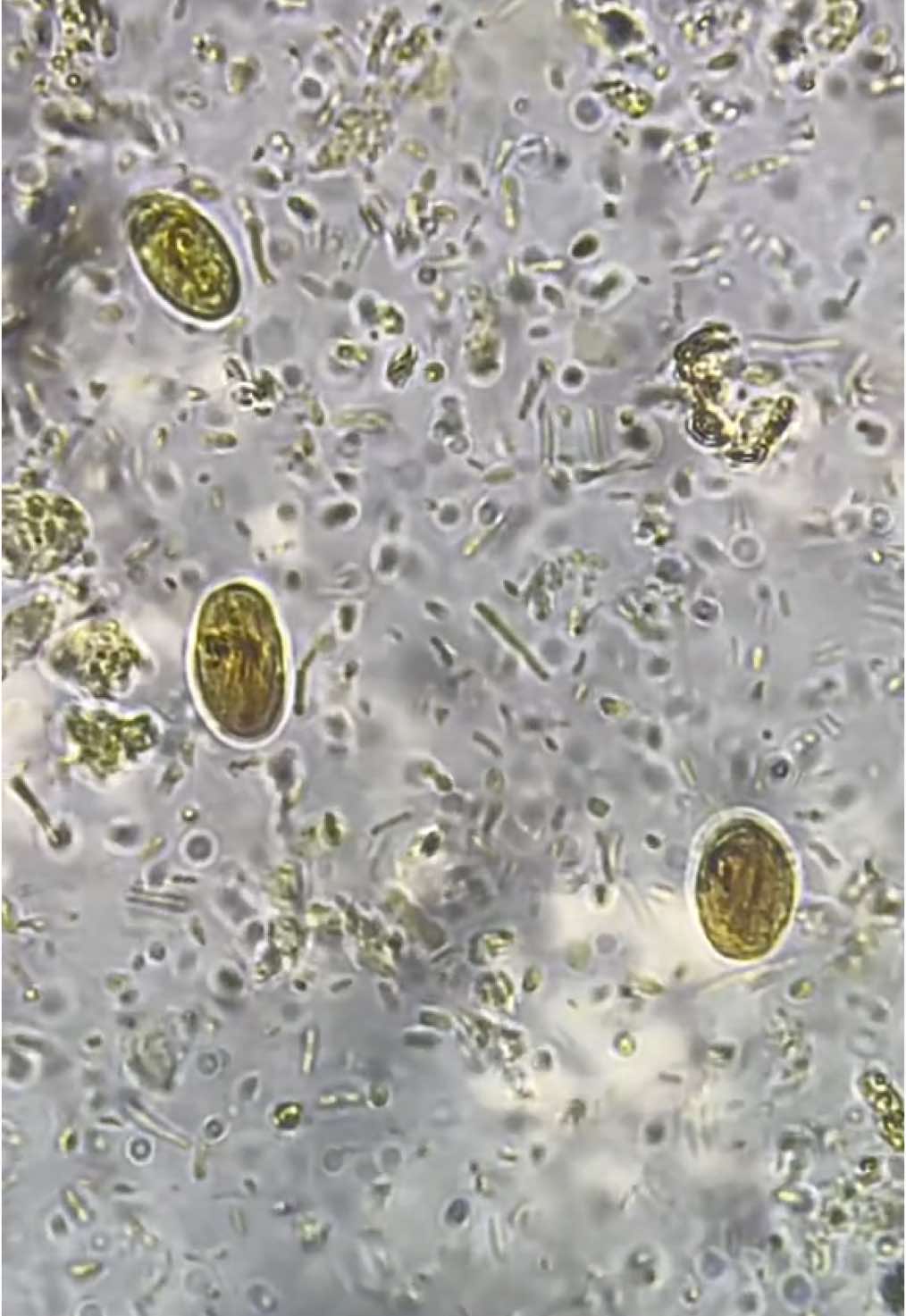 Quiste y trofozoito de Giardia lamblia 🪱. #parasitologia #giardialamblia #giardiasis #coprologico #coprologia #heces #microbiology #biologia #microscopio 