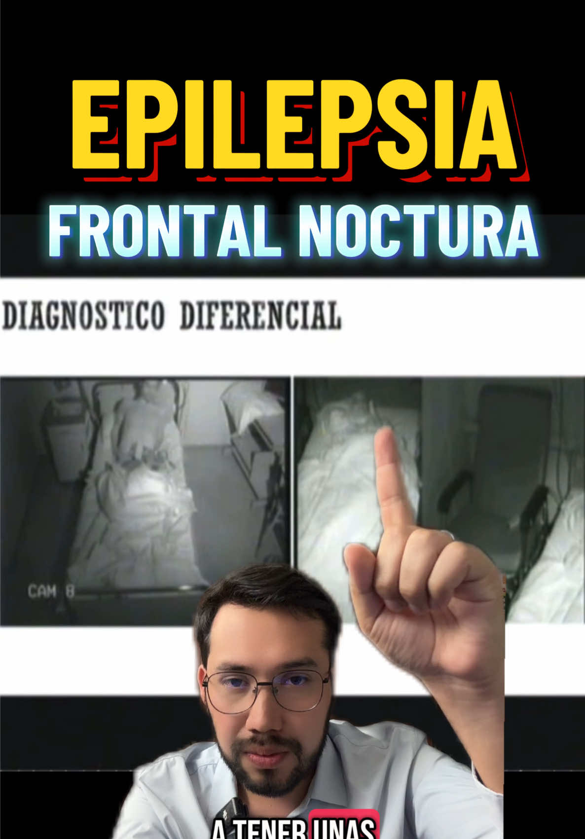 Epilepsia Frontal Noctura | Convulsiones mientras duermes | Sueño & Epilepsia #convulsion #epilepsia #neurology 
