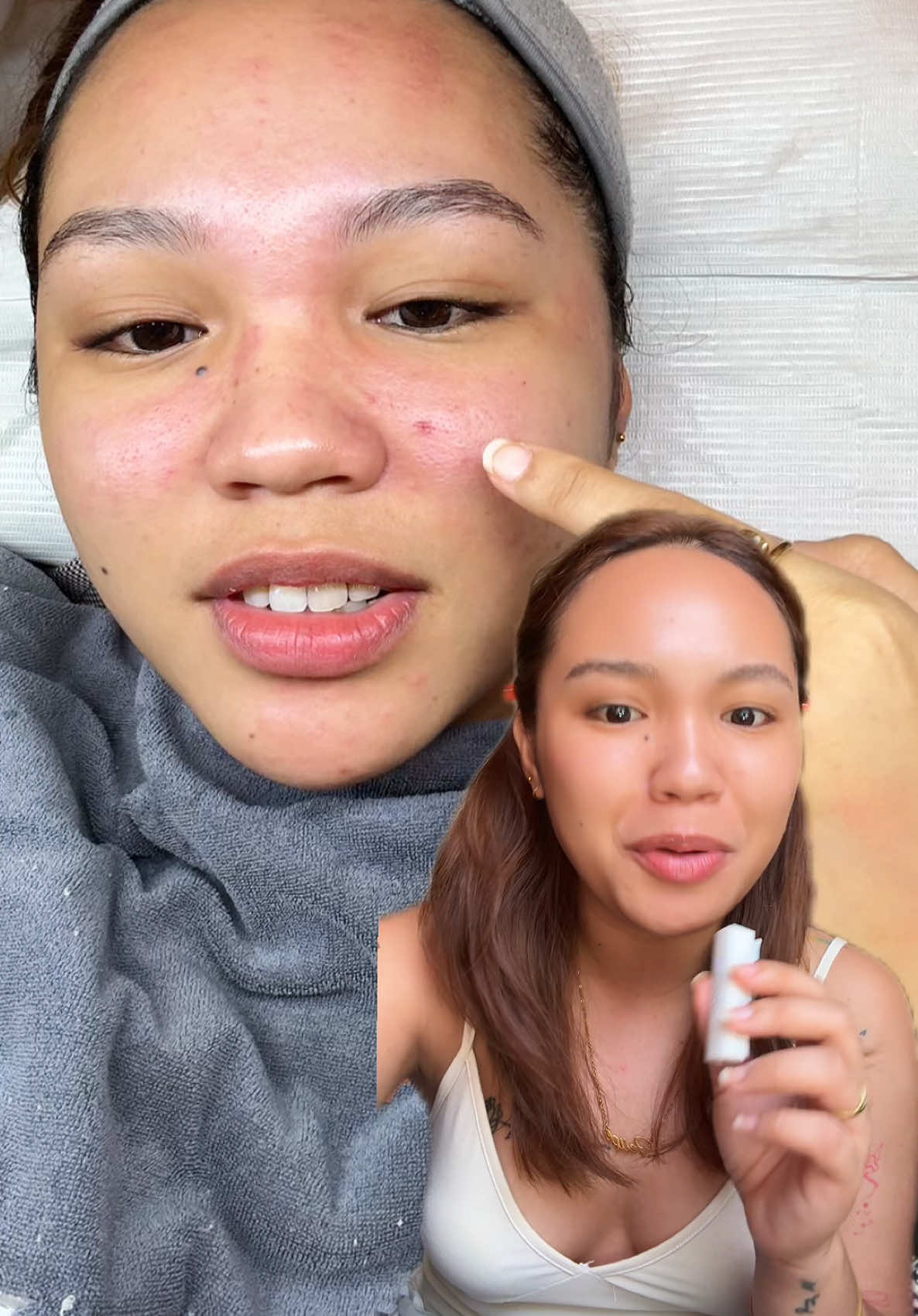 kung hindi kan nag eeexfoliate bakit ateko?!!🥲🥲 #gmeelan #skincaressentials #exfoliatinggel #skincaretips #exfoliation 