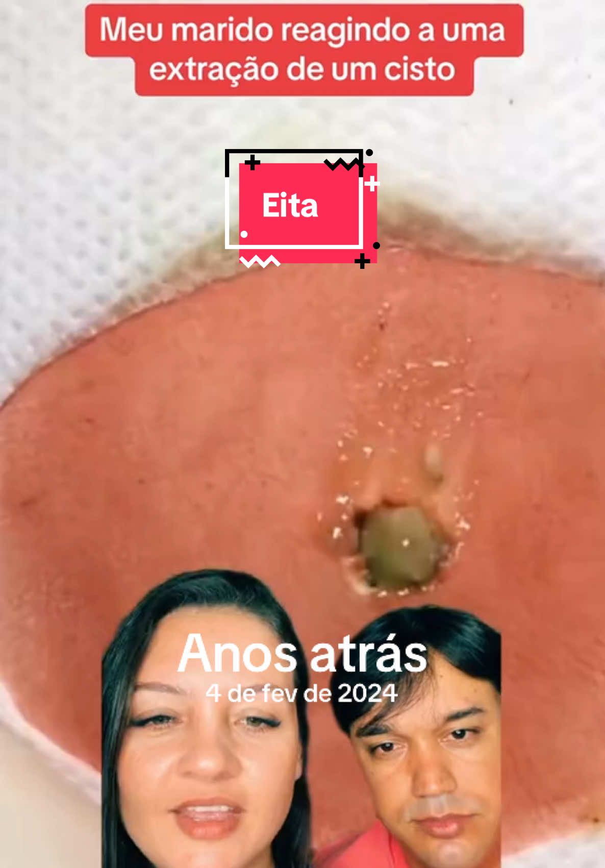 #anosatrás #cravos #terapia #reagindo 