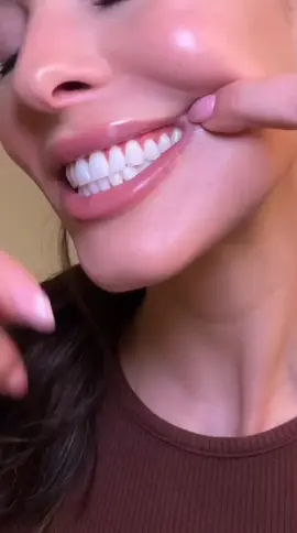 9D 5D 7 Pares Adesivos Claread0r Branqueadør Dentall Adesivo 9d White🫶🏻😱🥰🏃🏻‍♀️💨👀🔥🤌🏻🥰🏃🏻‍♀️🤳🏻💎#clareamento #clareamentodental #branqueador #adesivo #dentesbrancos #dentelle 