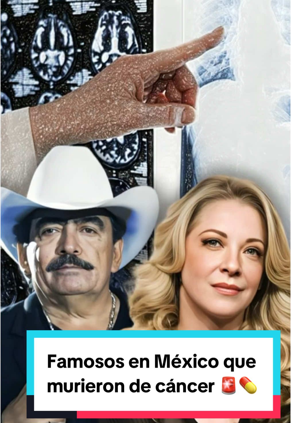 Famosos en #México que murieron de cáncer 🚨💊 #ParaTi #ForYou #ForYouPage #ParaTuPágina #DíaContraElCáncer