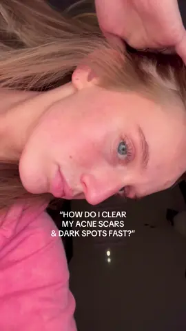 #INNISFREE_partner #INNISFREE #7daysDarkSpotChallenge #vitaCRapidDarkSpotSerum #glassskin #darkspots #koreanskincare #viralvitaminc #Sephora @Innisfree US @Innisfreeofficial #ad