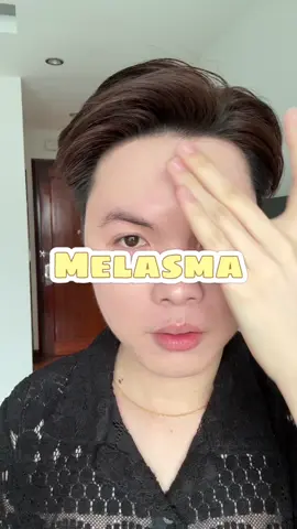 Chân ái mới #vuthaibinh #bbskincare #reviewlamdep #goclamdep #melasma 