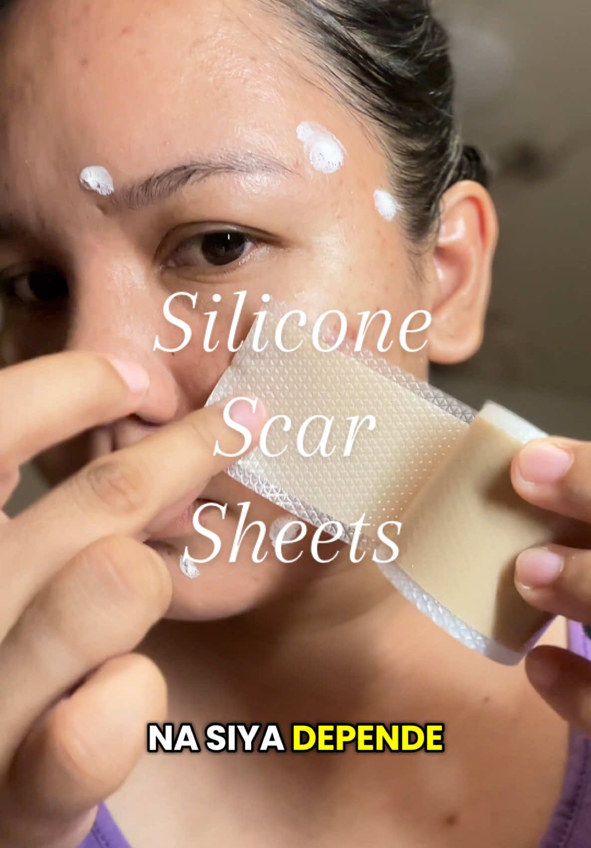 Trying out this Silicone Scar Sheets for my Acne Scars #siliconescarsheet #acnescars #acnemarks #acnetreatment #pittedscars #healingfromacne #acnegirlies #acne 