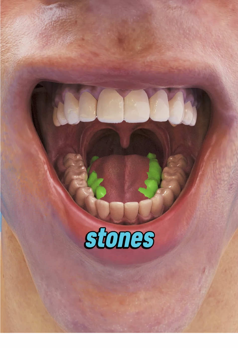 Bad Breath? Tonsil Stones Might Be to Blame! 🤔💨 