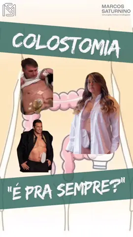 A colostomia é um procedimento cirúrgico que desvia o trânsito intestinal, permitindo que as fezes sejam eliminadas por uma abertura no abdômen chamada estoma. Esse processo pode ser temporário ou definitivo, dependendo da indicação e da condição de saúde do paciente. Infelizmente, o tema ainda carrega estigmas e desinformação. Por isso, é importante lembrar: 👉 Pessoas com colostomia podem viver de forma plena e ativa. 👉 É considerada uma deficiência não visível (oculta) - conheça os direitos da pessoa com colostomia: https://www.jusbrasil.com.br/noticias/conheca-os-direitos-da-pessoa-ostomizada/671078280 👉 Respeito e empatia são fundamentais para quebrar preconceitos. 👉 Todos os dias vidas são salvas graças a confecção da colostomia.